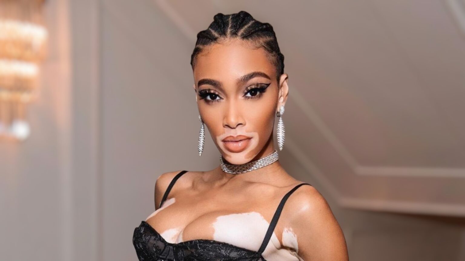 Winnie Harlow Inspiring Journey and Stunning Success