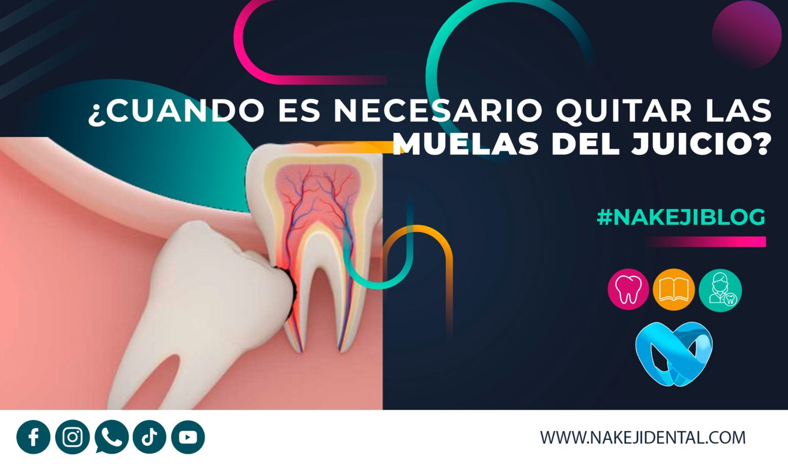 Como Desinflamar la Encía de la Muela del Juicio: Guía Completa para Aliviar el Dolor y la Inflamación